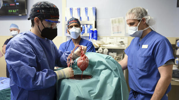 In a medical first, doctors transplanted a pig heart into a patient in a last-ditch effort to save his life and a Maryland hospital said Monday