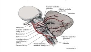 SUDDEN ONSET DEAFNESS IN AN ADULT